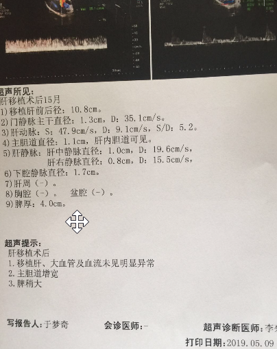 2019-05-09 B 超.png