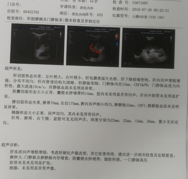 QQ图片20191017143359.png